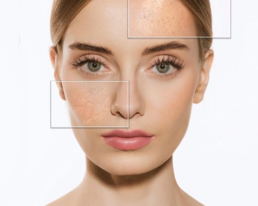 Skin Types & Care