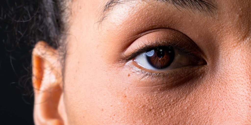 Dark Circle Remedy You Need: Natural Under-Eye Care with Coffee, Turmeric, Potato Juice & Honey Dark Circle Remedy